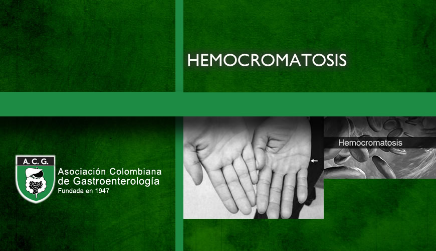 Hemocromatosis