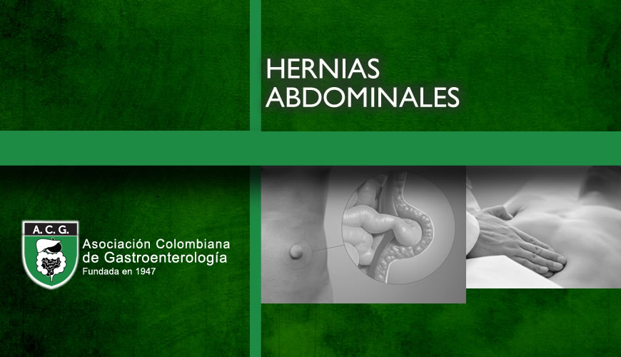 Hernias Abdominales